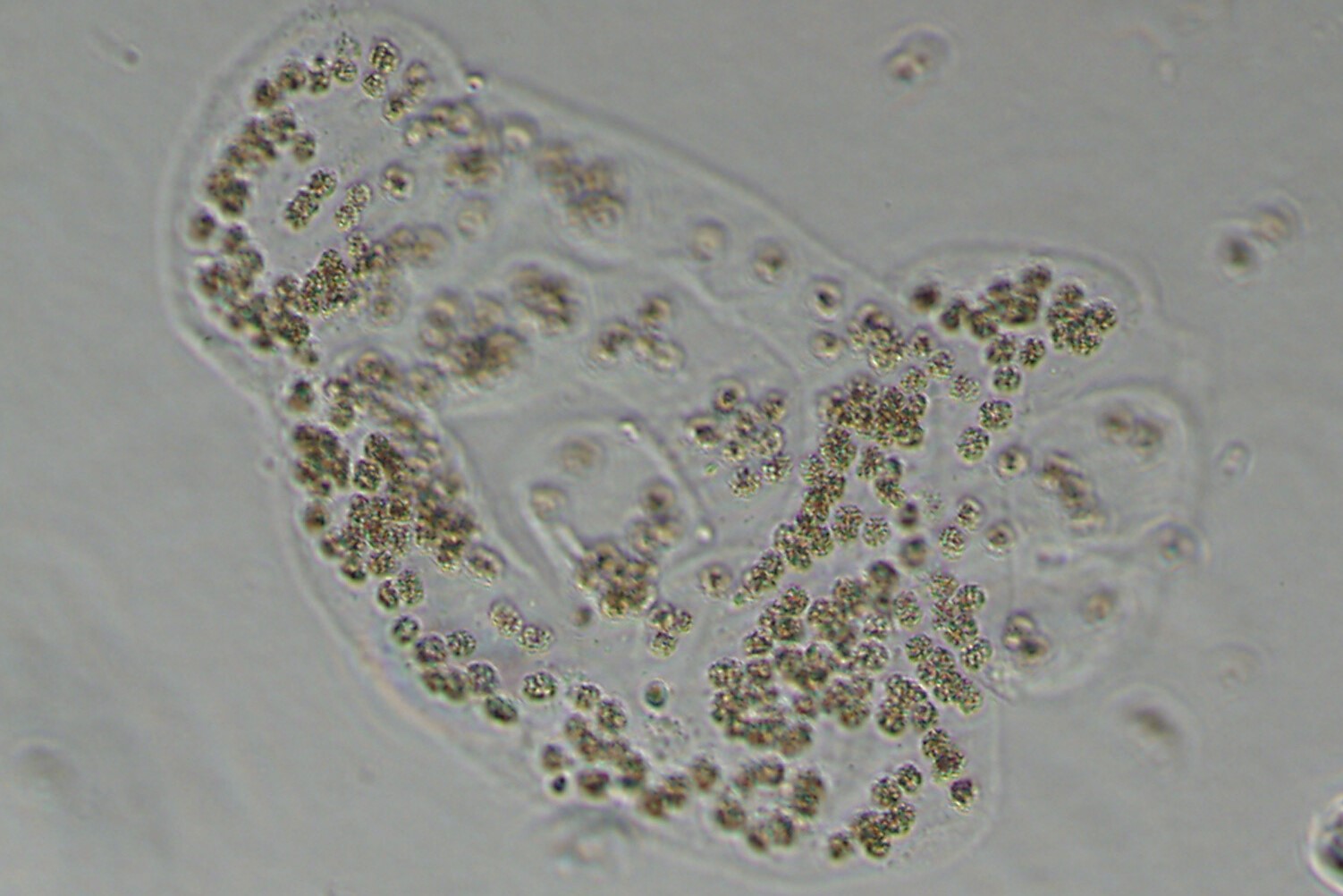 Light micrograph image of Mircrocystis wesenbergii