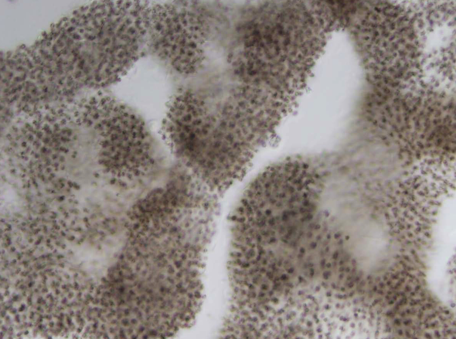 Light Micrograph of Microcystis aeruginosa